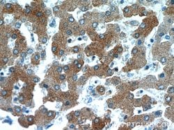 B3GALT6 Rabbit anti-Human, Mouse, Polyclonal, Proteintech 150 &mu;L; Unconjugated:Antibodies,
