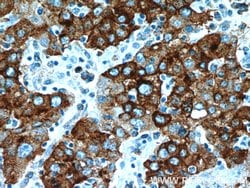 B3GALT6 Rabbit anti-Human, Mouse, Polyclonal, Proteintech 150 &mu;L; Unconjugated:Antibodies,