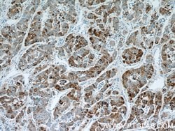 B3GALT6 Rabbit anti-Human, Mouse, Polyclonal, Proteintech 150 &mu;L; Unconjugated:Antibodies,