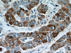 B3GALT6 Rabbit anti-Human, Mouse, Polyclonal, Proteintech 150 &mu;L; Unconjugated:Antibodies,