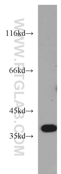 B3GALT6 Rabbit anti-Human, Mouse, Polyclonal, Proteintech 150 &mu;L; Unconjugated:Antibodies,
