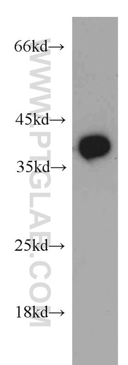 B3GALT6 Rabbit anti-Human, Mouse, Polyclonal, Proteintech 150 &mu;L; Unconjugated:Antibodies,