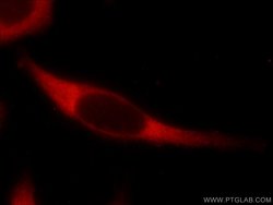 USP9X Rabbit anti-Human, Mouse, Rat, Polyclonal, Proteintech 150 &mu;L;