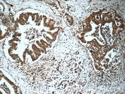 USP9X Rabbit anti-Human, Mouse, Rat, Polyclonal, Proteintech 150 &mu;L;