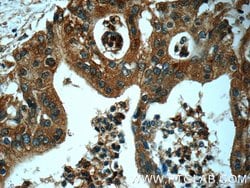 USP9X Rabbit anti-Human, Mouse, Rat, Polyclonal, Proteintech 150 &mu;L;
