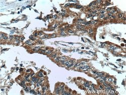 USP9X Rabbit anti-Human, Mouse, Rat, Polyclonal, Proteintech 150 &mu;L;
