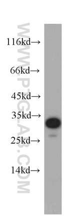 Thumbnail_PYCR2 Rabbit anti-Human, Polyclonal, Proteintech 150 &mu;L; Unconjugated:Antibodies