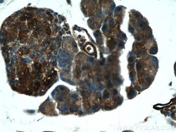 XYLT1 Rabbit anti-Human, Mouse, Rat, Polyclonal, Proteintech 150 &mu;L;