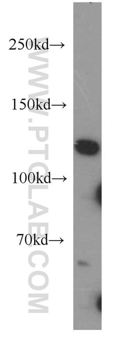 XYLT1 Rabbit anti-Human, Mouse, Rat, Polyclonal, Proteintech 150 &mu;L;
