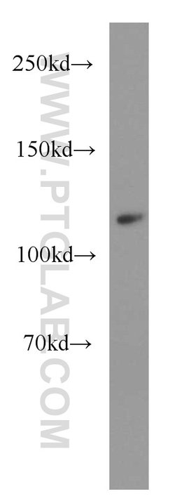 XYLT1 Rabbit anti-Human, Mouse, Rat, Polyclonal, Proteintech 150 &mu;L;