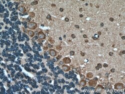 MTCO3 Rabbit anti-Human, Mouse, Rat, Polyclonal, Proteintech:Antibodies:Primary