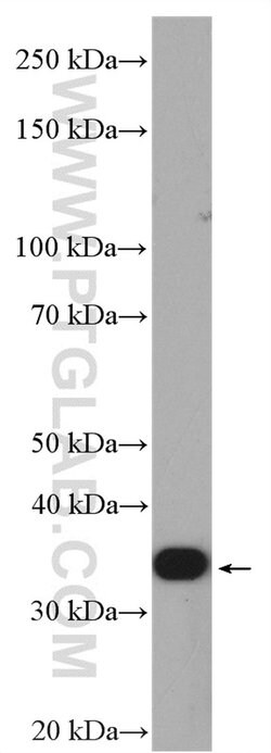 MTCO3 Rabbit anti-Human, Mouse, Rat, Polyclonal, Proteintech:Antibodies:Primary