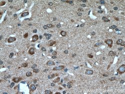 MTCO3 Rabbit anti-Human, Mouse, Rat, Polyclonal, Proteintech:Antibodies:Primary