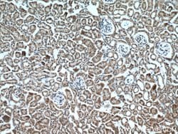 MTCO3 Rabbit anti-Human, Mouse, Rat, Polyclonal, Proteintech:Antibodies:Primary