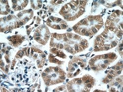 MTCO3 Rabbit anti-Human, Mouse, Rat, Polyclonal, Proteintech:Antibodies:Primary