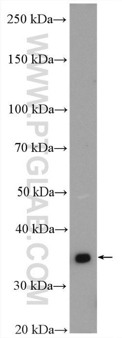 MTCO3 Rabbit anti-Human, Mouse, Rat, Polyclonal, Proteintech:Antibodies:Primary