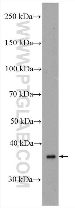 MTCO3 Rabbit anti-Human, Mouse, Rat, Polyclonal, Proteintech:Antibodies:Primary