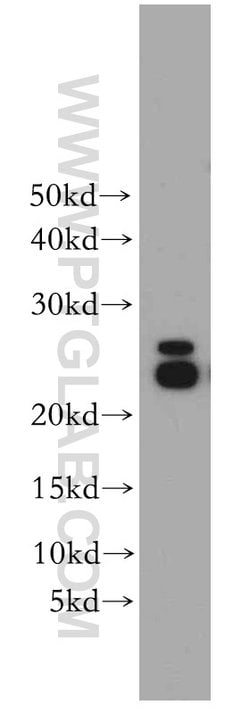 PRDX3 Rabbit anti-Human, Mouse, Rat, Polyclonal, Proteintech:Antibodies:Primary