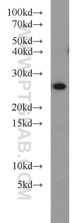 PRDX3 Rabbit anti-Human, Mouse, Rat, Polyclonal, Proteintech:Antibodies:Primary