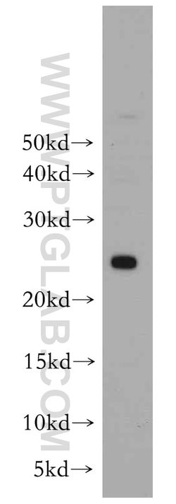 PRDX3 Rabbit anti-Human, Mouse, Rat, Polyclonal, Proteintech:Antibodies:Primary