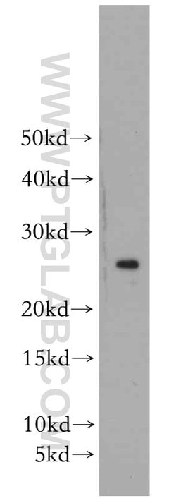 PRDX3 Rabbit anti-Human, Mouse, Rat, Polyclonal, Proteintech:Antibodies:Primary