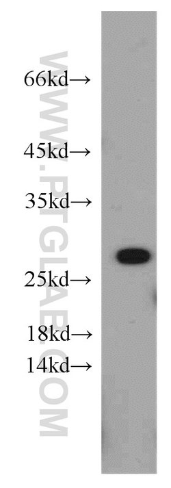PRDX3 Rabbit anti-Human, Mouse, Rat, Polyclonal, Proteintech:Antibodies:Primary