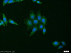 CYTB Rabbit anti-Human, Mouse, Polyclonal, Proteintech:Antibodies:Primary