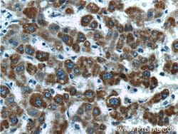 CYTB Rabbit anti-Human, Mouse, Polyclonal, Proteintech:Antibodies:Primary