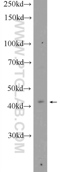 CYTB Rabbit anti-Human, Mouse, Polyclonal, Proteintech:Antibodies:Primary