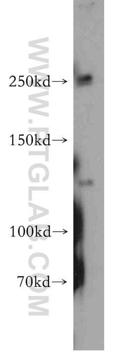 Proteintech PTCH2 Rabbit anti-Human, Mouse, Rat, Polyclonal, Proteintech