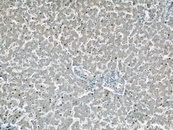 GDI2 Rabbit anti-Human, Polyclonal, Proteintech 150 &mu;L; Unconjugated:Antibodies,