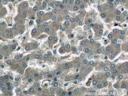 GDI2 Rabbit anti-Human, Polyclonal, Proteintech 150 &mu;L; Unconjugated:Antibodies,