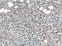 CDK3 Rabbit anti-Human, Mouse, Polyclonal, Proteintech:Antibodies:Primary