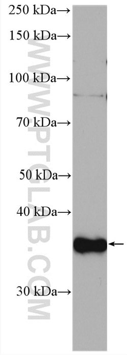 CDK3 Rabbit anti-Human, Mouse, Polyclonal, Proteintech:Antibodies:Primary