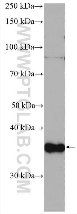 CDK3 Rabbit anti-Human, Mouse, Polyclonal, Proteintech:  