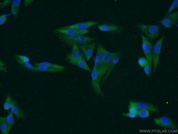 MAGEA1 Rabbit anti-Human, Polyclonal, Proteintech 150 &mu;L; Unconjugated:Antibodies,