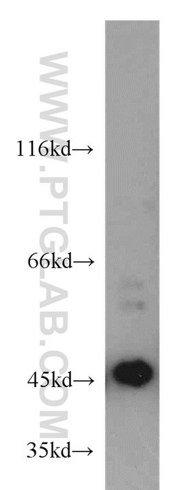 MAGEA1 Rabbit anti-Human, Polyclonal, Proteintech 150 &mu;L; Unconjugated:Antibodies,