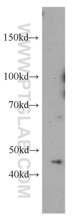 MAGEA1 Rabbit anti-Human, Polyclonal, Proteintech 150 &mu;L; Unconjugated:Antibodies,
