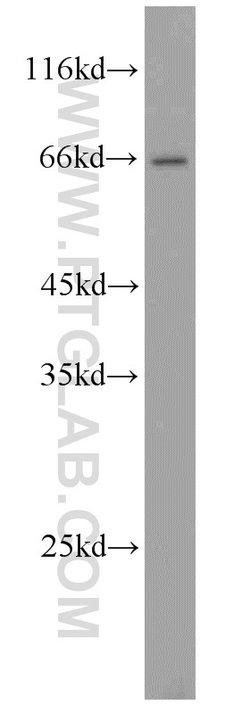 MEKK2 Rabbit anti-Human, Mouse, Rat, Polyclonal, Proteintech:Antibodies:Primary