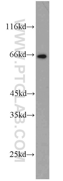 MEKK2 Rabbit anti-Human, Mouse, Rat, Polyclonal, Proteintech:Antibodies:Primary