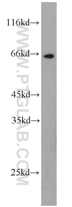 MEKK2 Rabbit anti-Human, Mouse, Rat, Polyclonal, Proteintech:Antibodies:Primary