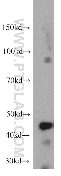 NUDT19 Rabbit anti-Human, Polyclonal, Proteintech 150 &mu;L; Unconjugated:Antibodies,