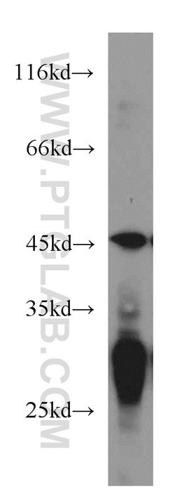 NUDT19 Rabbit anti-Human, Polyclonal, Proteintech 150 &mu;L; Unconjugated:Antibodies,
