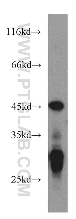 NUDT19 Rabbit anti-Human, Polyclonal, Proteintech 150 &mu;L; Unconjugated:Antibodies,
