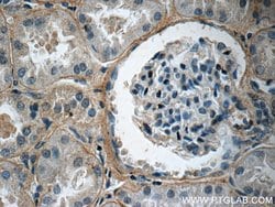Collagen Type IV Rabbit anti-Human, Polyclonal, Proteintech 150 &mu;L;