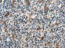 CD30 Rabbit anti-Human, Polyclonal, Proteintech:Antibodies:Primary Antibodies