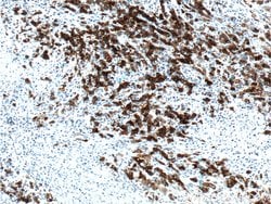 CD30 Rabbit anti-Human, Polyclonal, Proteintech:Antibodies:Primary Antibodies