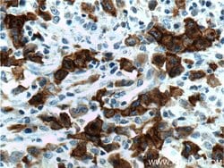 CD30 Rabbit anti-Human, Polyclonal, Proteintech:Antibodies:Primary Antibodies