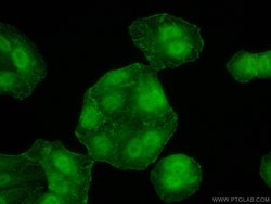 PPP1CB Rabbit anti-Human, Mouse, Rat, Polyclonal, Proteintech:Antibodies:Primary