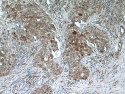 LTB4R Rabbit anti-Human, Polyclonal, Proteintech:Antibodies:Primary Antibodies